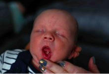Фото - Один из тысяч: маленький британец родился с зубом