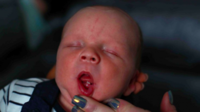 Фото - Один из тысяч: маленький британец родился с зубом