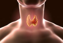 Фото - Причины, которые могут вызвать проблемы с щитовидной железой