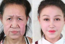Фото - В Китае врачи подарили больной девочке новое лицо