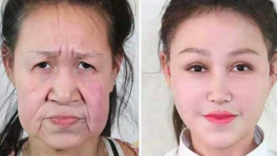 Фото - В Китае врачи подарили больной девочке новое лицо