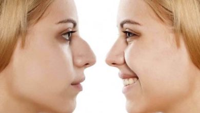 Фото - Хирурги научились изменять форму носа пациентам без операции