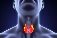 Фото - Опухоль щитовидной железы: признаки, с которыми нужно к врачу